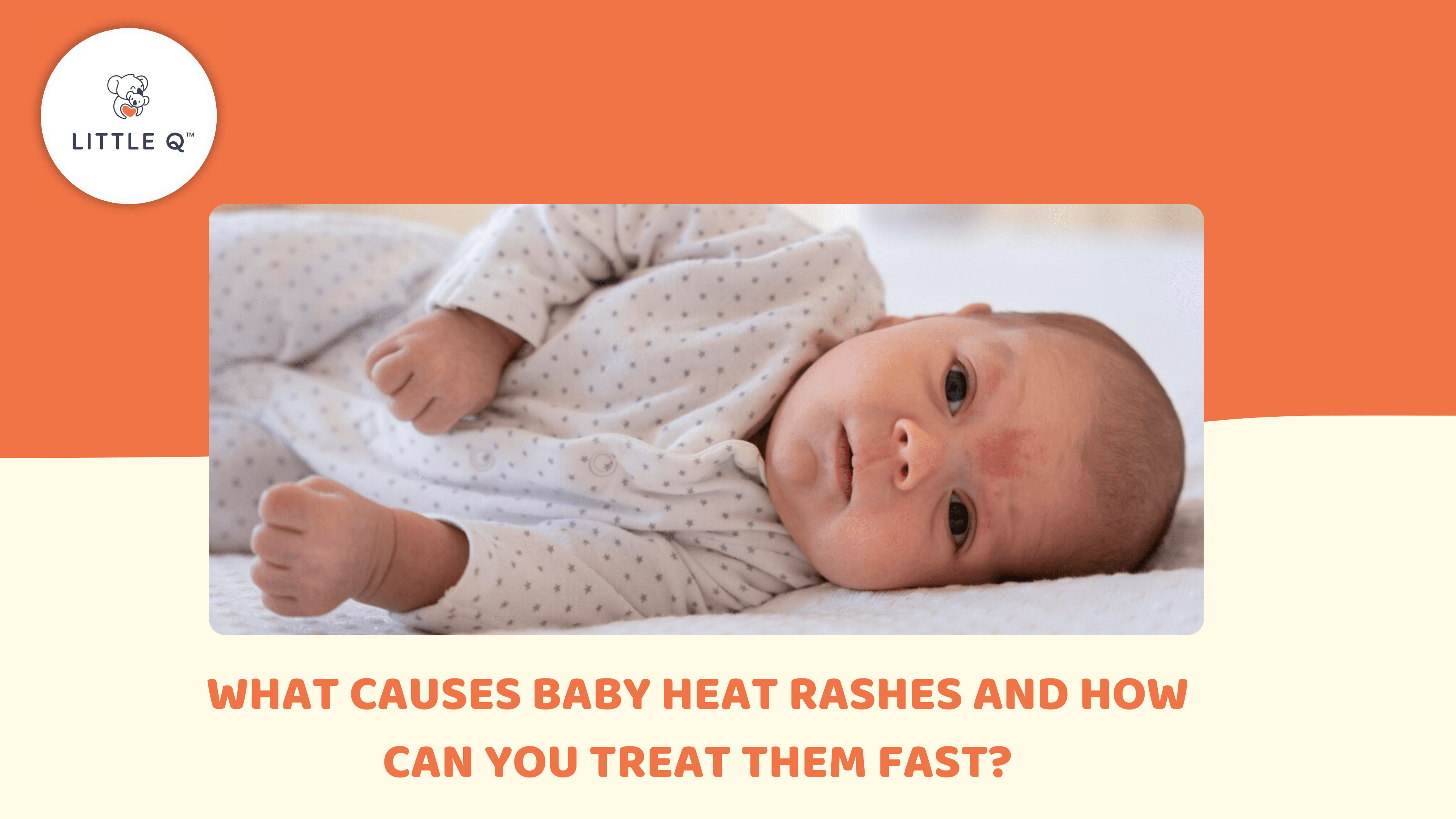 What Causes Baby Heat Rashes and How Can You Treat Them Fast?